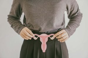 Read more about the article Empowering Your Journey: Losing Weight with Polycystic Ovary Syndrome (PCOS)